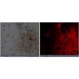 Optosys: Porphyrin probe - Specific blood detection using a PORPHYRIN probe
